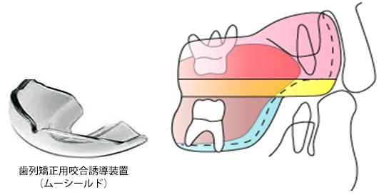 ムーシールドの作用